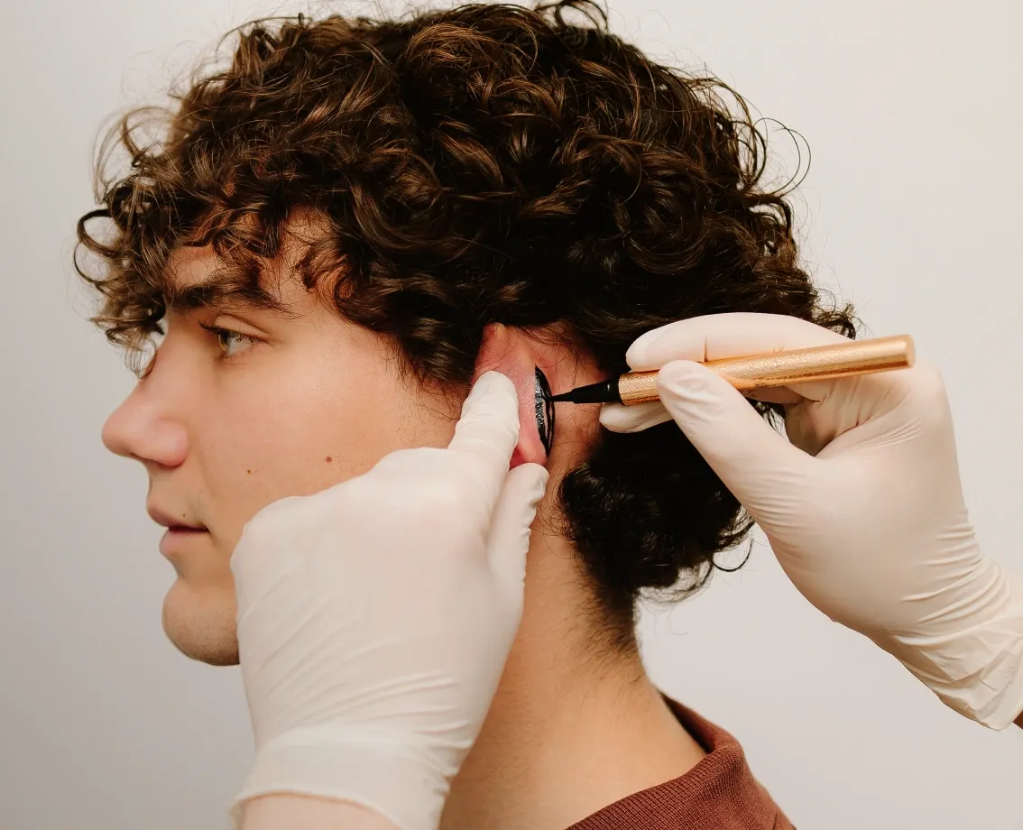 Pinnaplasty procedure